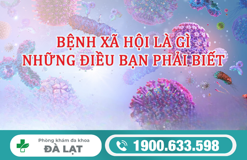 Hình ảnh minh họa